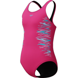 Placement Muscleback 1pc