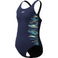 Placement Muscleback 1pc