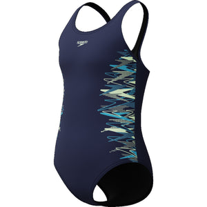Placement Muscleback 1pc